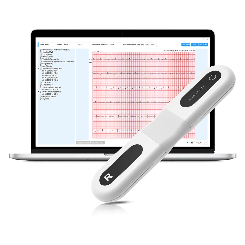 24/72-Hour ECG Recorder with Screen